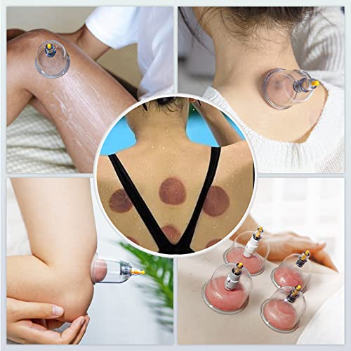 KingPavonini 24 Cups Cupping Therapy Set, Professional Chinese Cupping Set with Magnetics, Portable Vacuum Cupping for Cellulite Reduction, Pain Relief and Blood Circulation