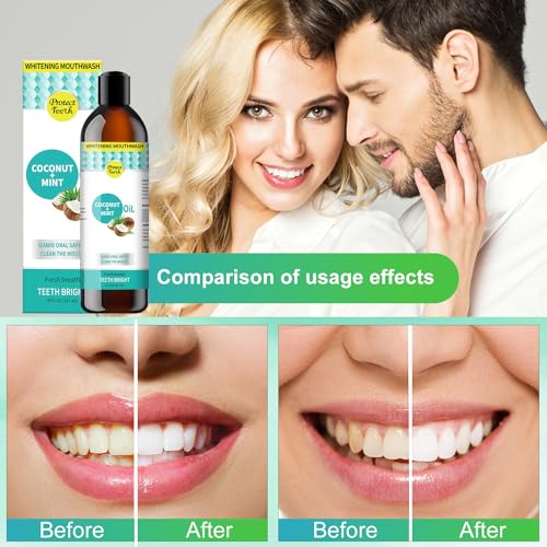 Generic 2pcs Oral Mouthwash, Gum Health Mouthwash, Mouthwash Toothpaste Foam,Teeth Whitening, (B)