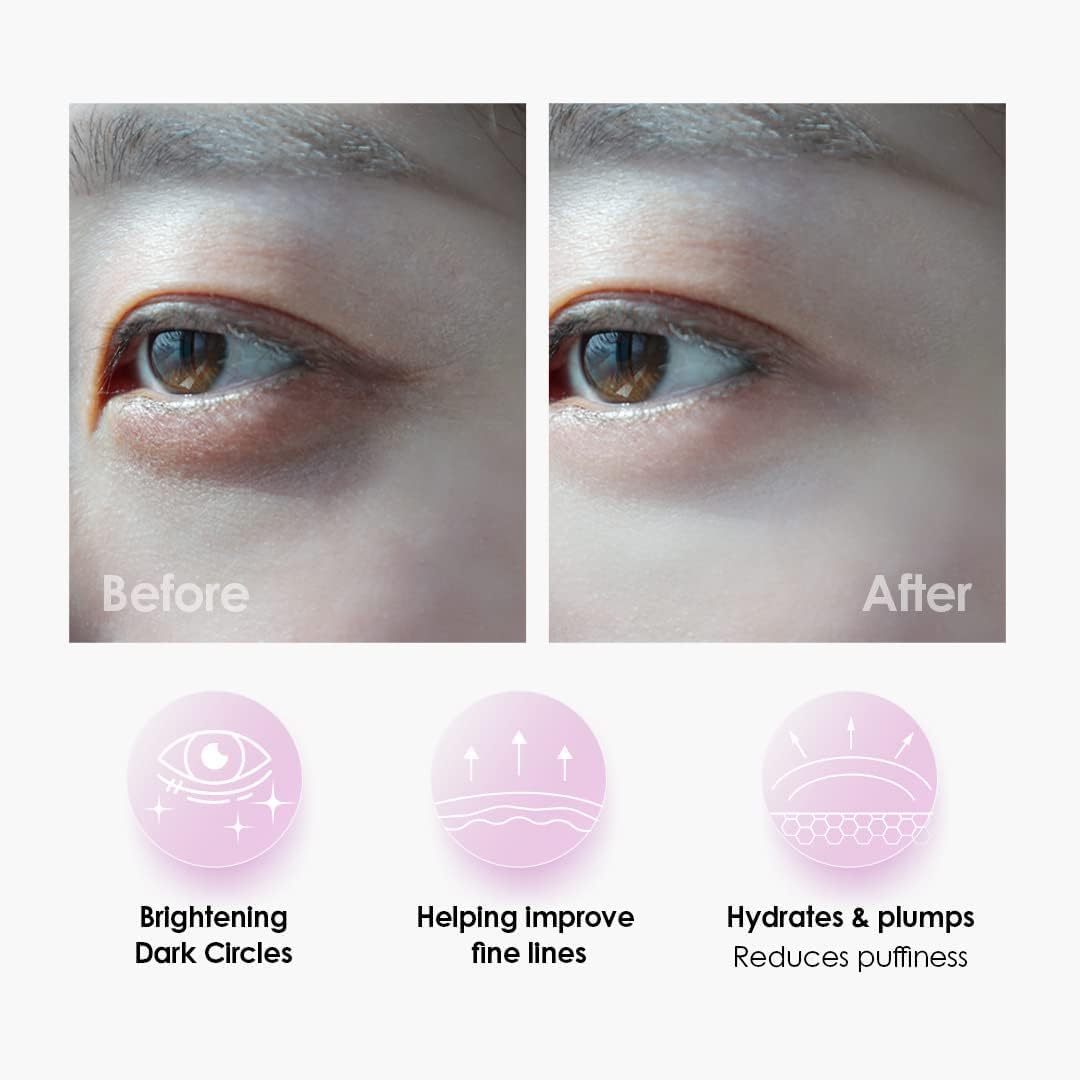 Sweet Dreams Collagen Glow Rose Gold Eye Masks - Korean Under Eye Patches Puffy Eyes, Dark Circles & Wrinkles | Collagen, Niacinamide, Hyaluronic Acid & Peptides | Hydrating Eye Treatment & BeautyCare