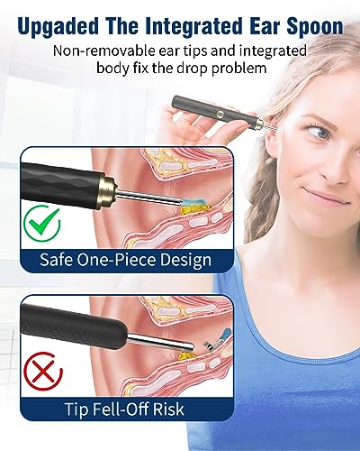 Kekoy Ear Wax Removal Camera, Ear Cleaner 1296P HD Camera, Ear Cleaning Kit with 8pcs Ear Set, Wireless WiFi Otoscope with 6 Lights, Rechargeable Earwax Removal Tool Kit for Adult & Kid(Black)