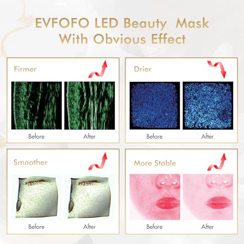 EVFOFO 7 Colors LED Face Mask Light Therapy, Led Face Mask Light Therapy At Home, Blue Red Light Therapy Mask for Face