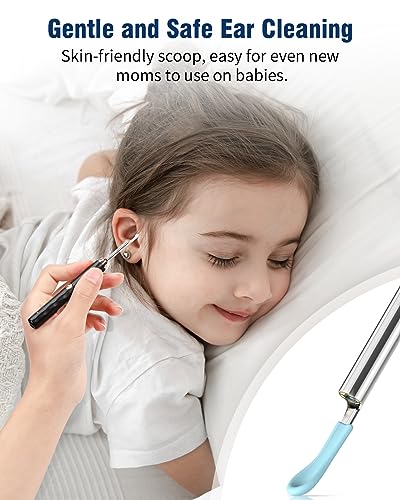 Kekoy Ear Wax Removal Camera, Ear Cleaner 1296P HD Camera, Ear Cleaning Kit with 8pcs Ear Set, Wireless WiFi Otoscope with 6 Lights, Rechargeable Earwax Removal Tool Kit for Adult & Kid(Black)