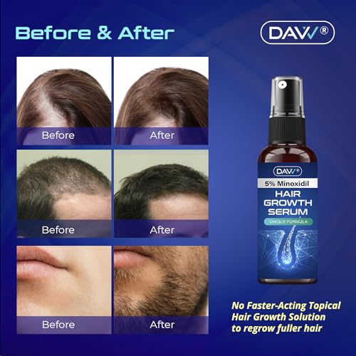 Hair Growth Serum for Men and Women: 5% Minoxidil with Biotin for Thicker, Longer Hair, Beard Regrowth, and Stronger Growth - 60ml Spray Treatment