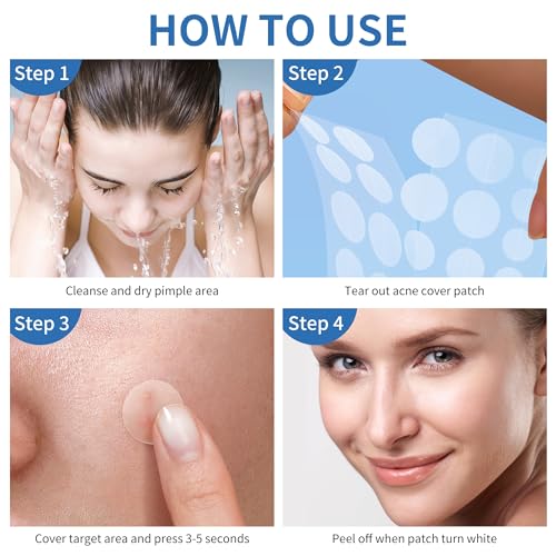 Daolyo Pimple Patches for Face, 4 Size 300 Counts Acne Patches, Hydrocolloid Patches for Covering Zits and Blemishes, Spot Stickers with Salicylic Acid, Tea Tree Oil & Calendula Oil