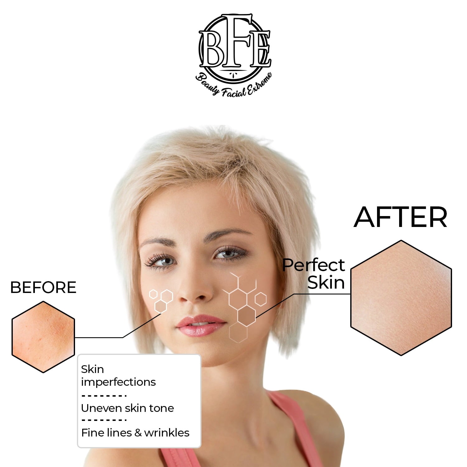 Beauty Facial Extreme Anti-Aging Resurfacing Peel Pads