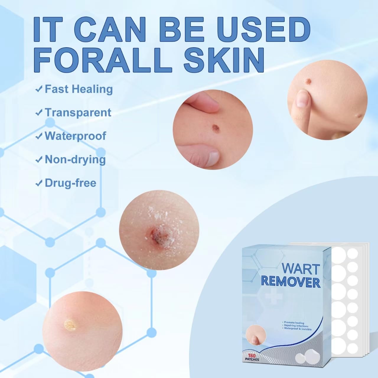 Bureebo Wart Remover,Fast & Easy Operate Hydrocolloid Gel Waterproof Invisible Sticker,Quick and Effective Removal Sticker for All Kinds of Skin, Friendly to New-User