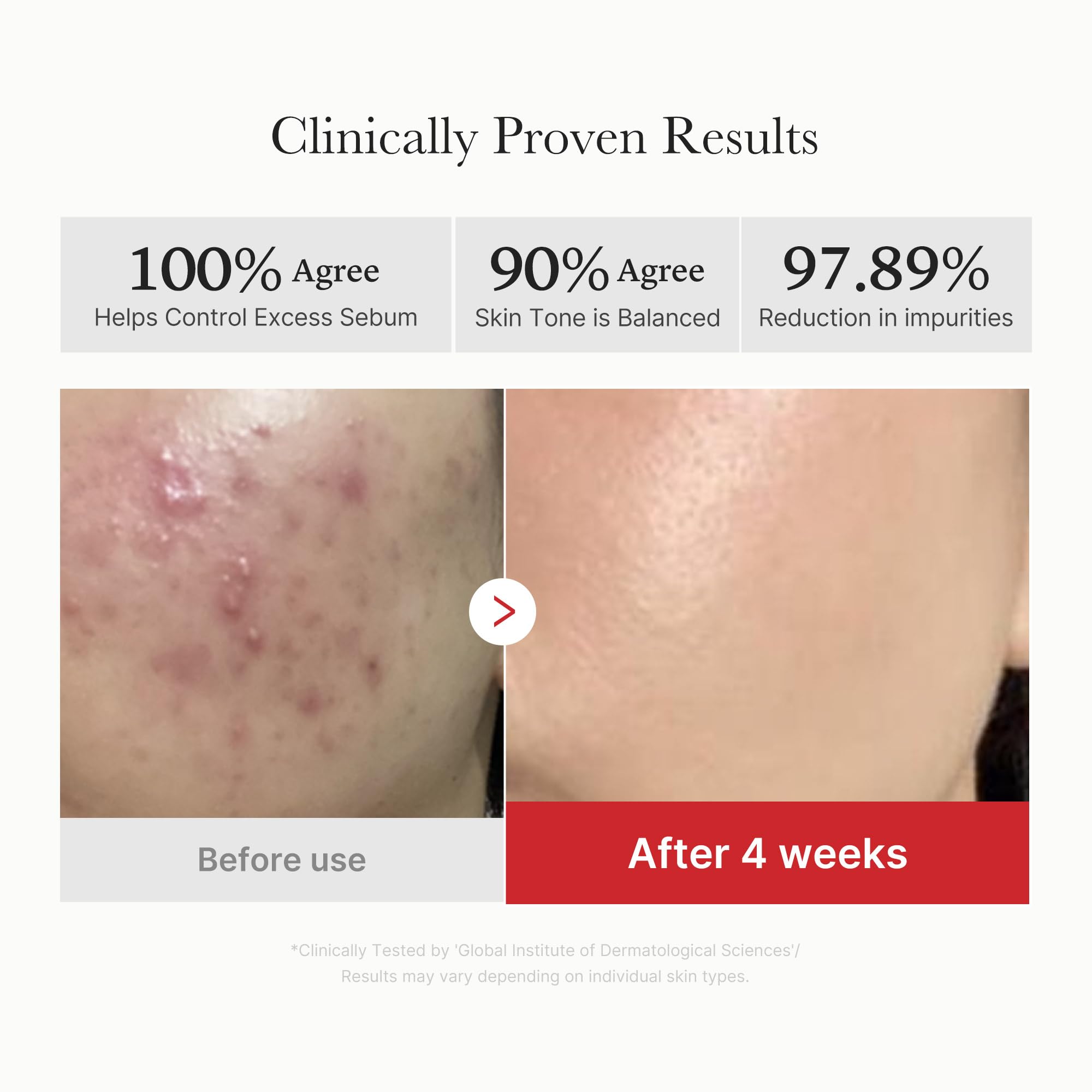 Medicube Red Succinic Acid Panthenol Facial Peeling Pads - Exfoliating Toner Pads for Breakout-Prone Skin with Niacinamide, AHA, BHA, and Soothing Panthenol - Non-Comedogenic