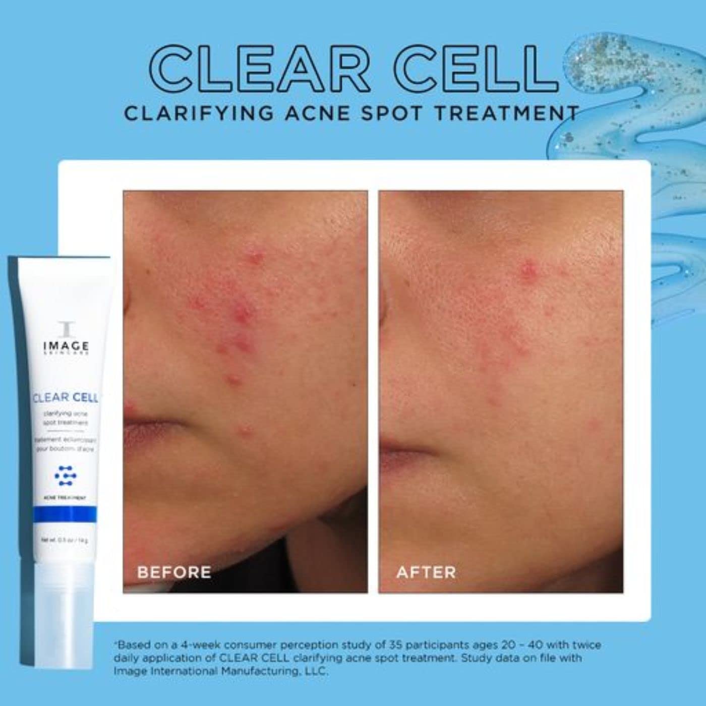 IMAGE Skincare, CLEAR CELL Clarifying Acne Spot Treatment, with Salicylic Acid, Targets Existing Acne Blemishes while Preventing New Blemishes from Forming, 0.5 oz