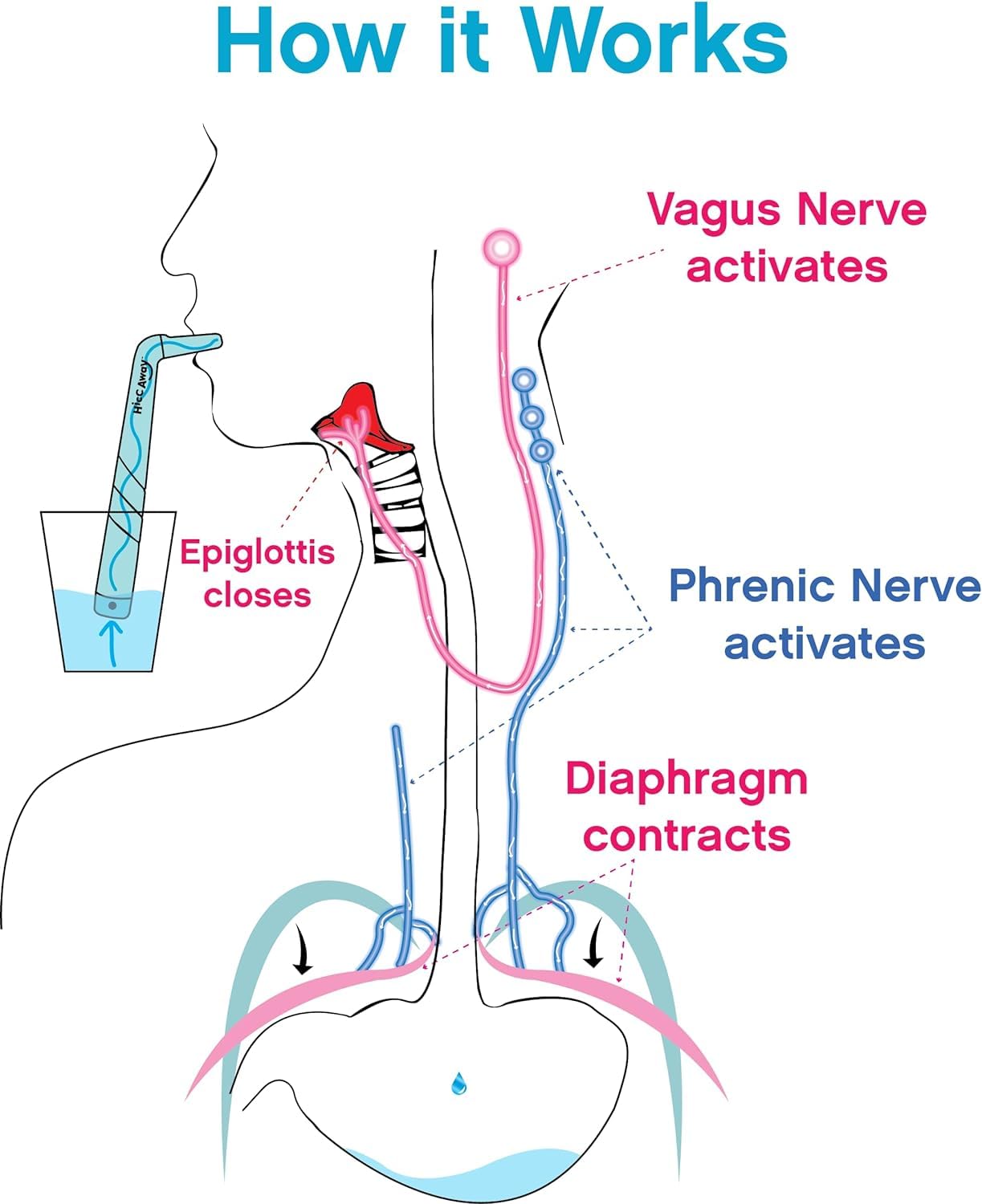 HiccAway Hiccup Straw - Stops Hiccups Naturally & Fast - As Seen On Shark Tank - Clinically Proven Relief for All Ages, Children & Adults - Safe, Lightweight, & Reusable (HiccAway Baby Blue) 1 Pack