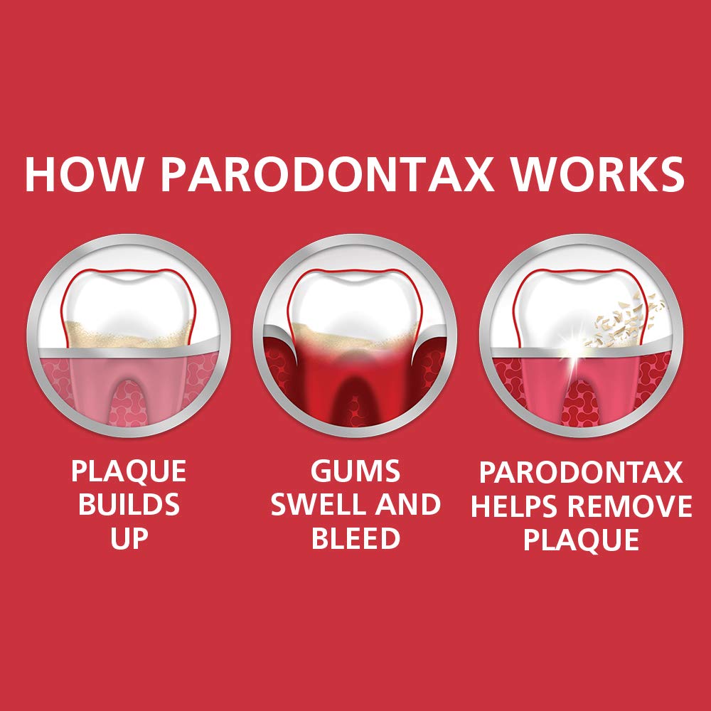 Parodontax Whitening Toothpaste for Bleeding Gums, Teeth Whitening and Gingivitis Treatment - 3.4 Ounces