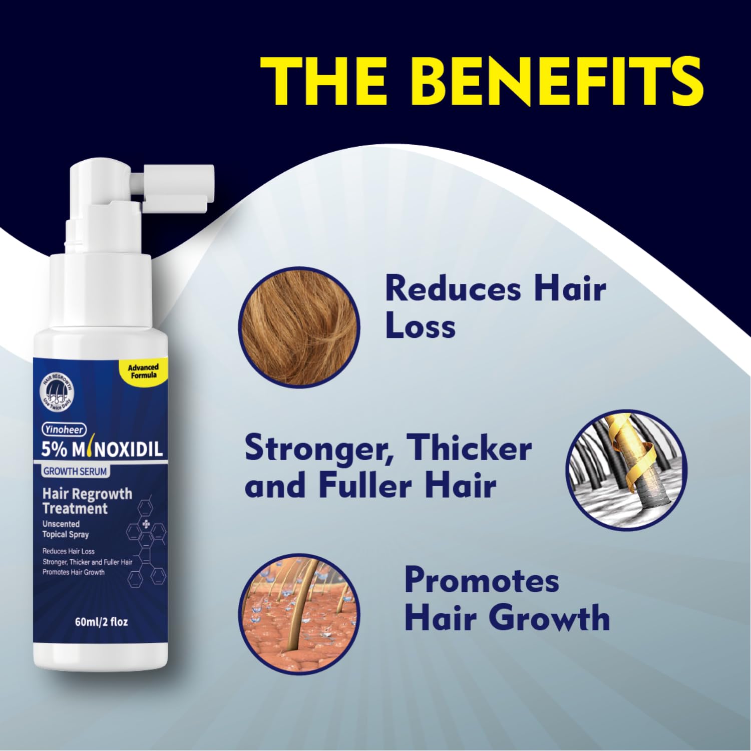 5% Minoxidil Spray for Men and Women, Extra Strength Hair Regrowth Treatment for Men and Women to Combat Hair Loss & Thinning Hair, Topical Solution, No Mess Sprayer, 2-Pack