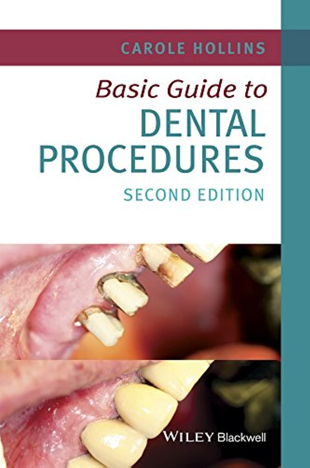 Basic Guide to Dental Procedures (Basic Guide Dentistry)