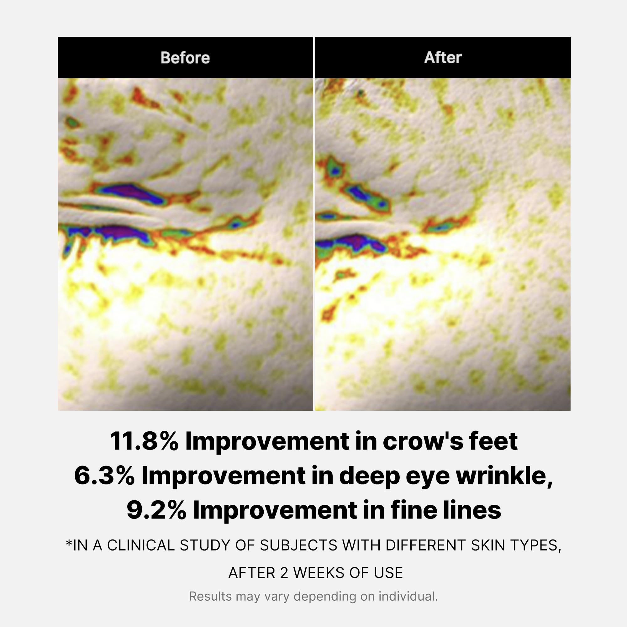 medicube Deep Reviving Peptide Eye Serum 1.01 Fl. Oz., | Eye Treatment Serum with Quadruple Peptides, Niacinamide, and Squalane | Reduces Signs of Aging and Fine Lines