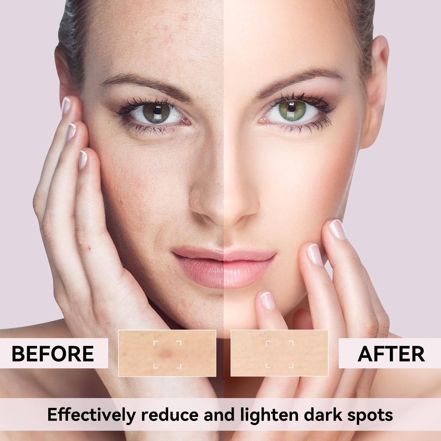 Dark Spot Remover for Face and Body: Dark Spot Remover for Age Spot Sun Spot Melasma Uneven Skin Tone, with Vitamin C and Hyaluronic Acid for Women and Men (1.7 Fl Oz)