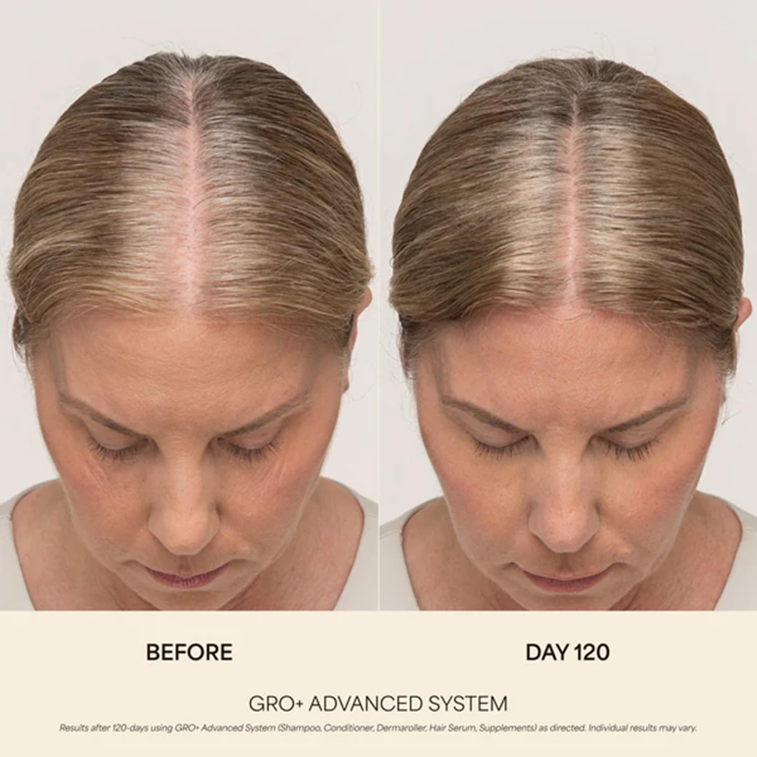 VEGAMOUR GRO+ Advanced Hair Serum for Improving Hair Density, Tonic Reduces Shedding and Promotes a Healthy Scalp, 30 Day Supply, 1 fl oz, New Packaging