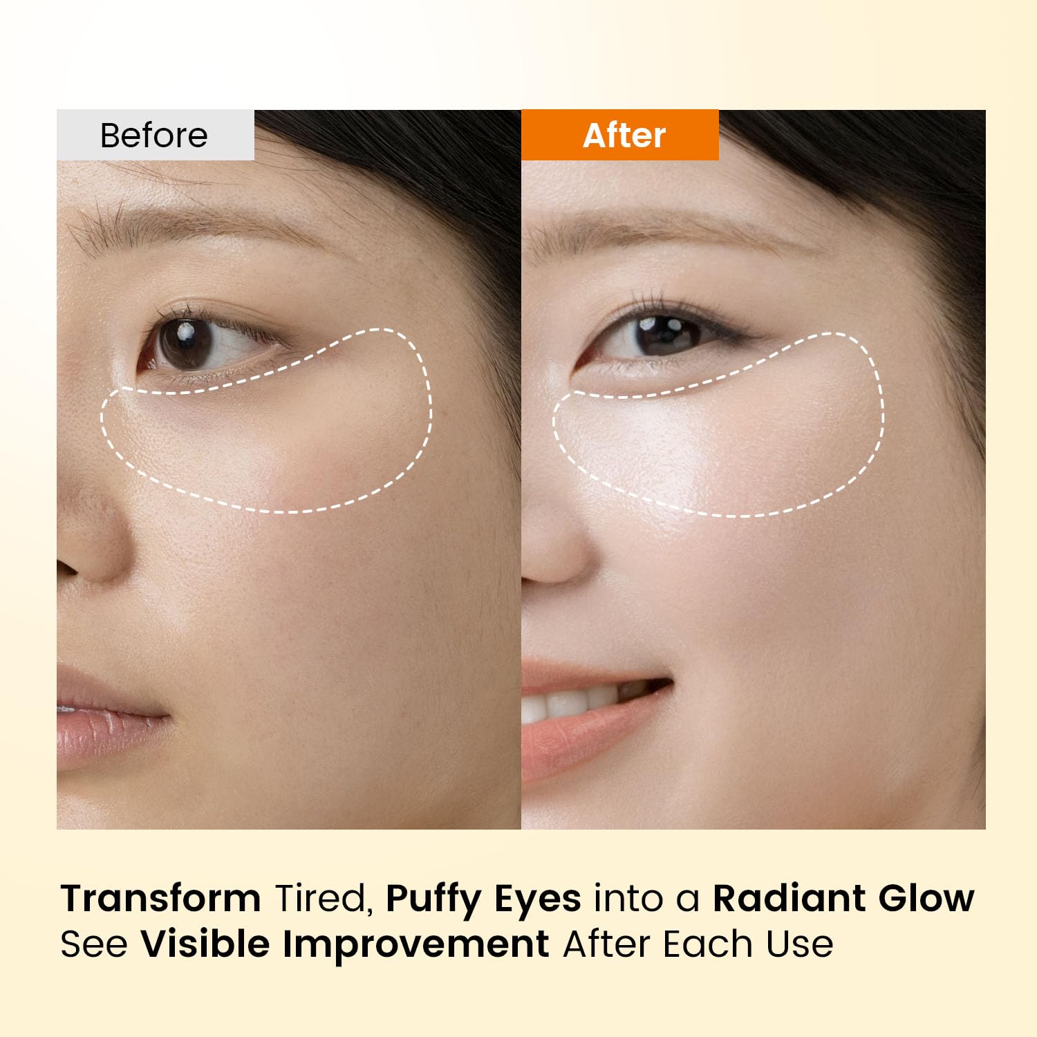 SEONGLOW Caffeine Under Eye Patches: 30 Pairs Korean Hydrogel Eye Masks for Dark Circles Puffiness Relief with Niacinamide Hyaluronic Acid - Undereye Brightening Hydrating Anti-Wrinkle Treatment