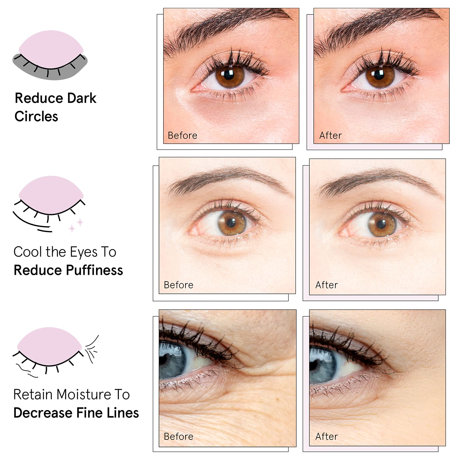 grace & stella Award Winning Under Eye Mask - Christmas Gifts for Women, Christmas Gifts for Mom - Reduce Dark Circles, Puffy Eyes, Undereye Bags, Wrinkles - Under Eye Patches - Vegan (24 Pairs, Pink)