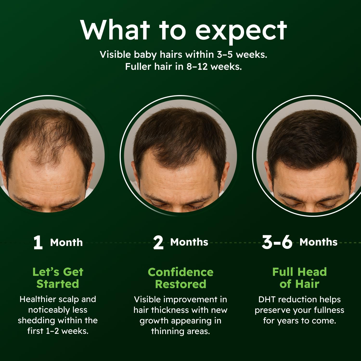 AlphaInfuse™ Scalp Nourishing Serum for Men – Ginseng & Eclipta Botanical Blend for Fuller-Looking, Thicker-Looking Hair and Healthy Scalp – 32ml – 2 Month Supply