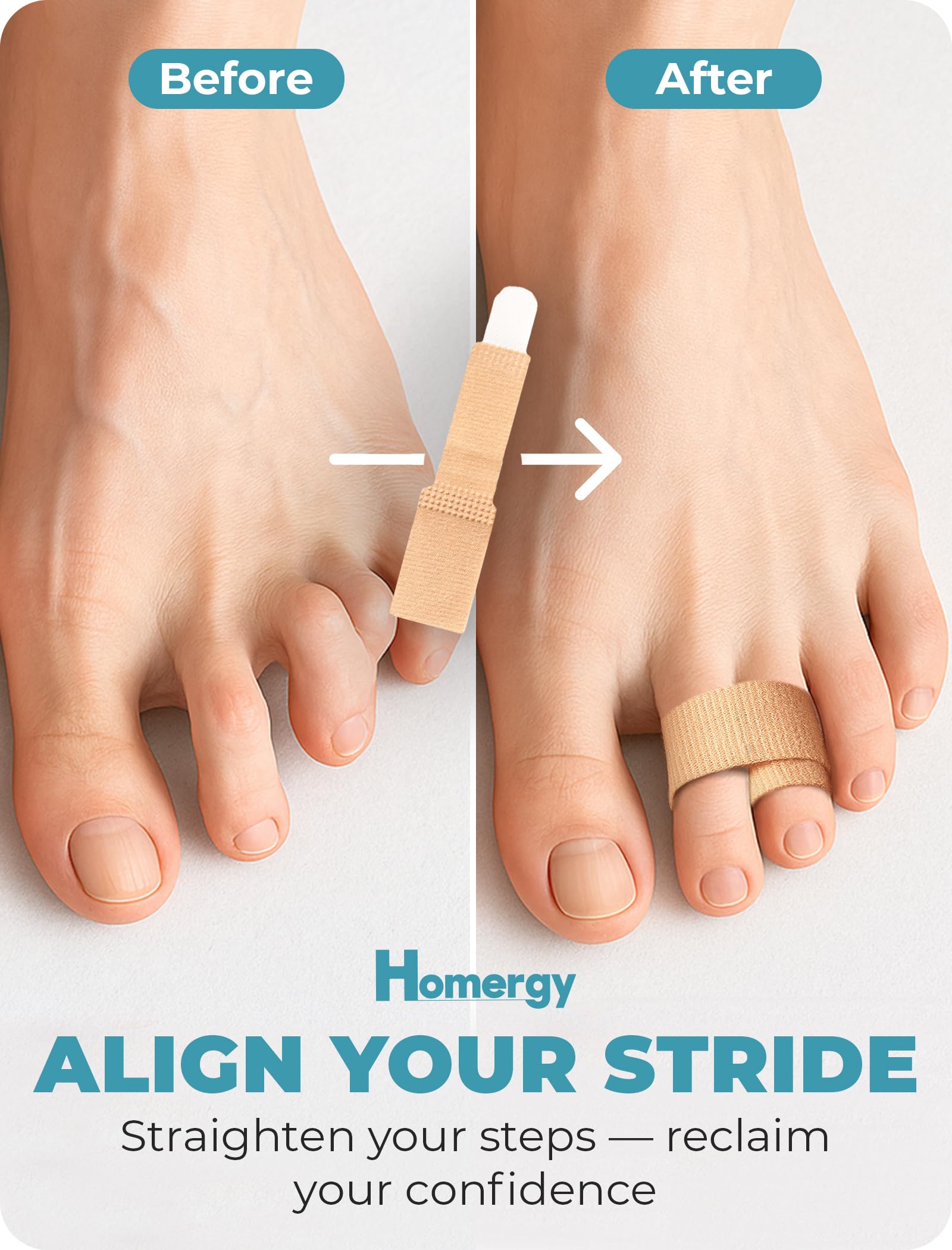 Homergy Hammer Toe corrector for Women and Men, 4 Pack, Reusable Fabric Buddy Wraps for Broken Toes, Hammertoe Corrector