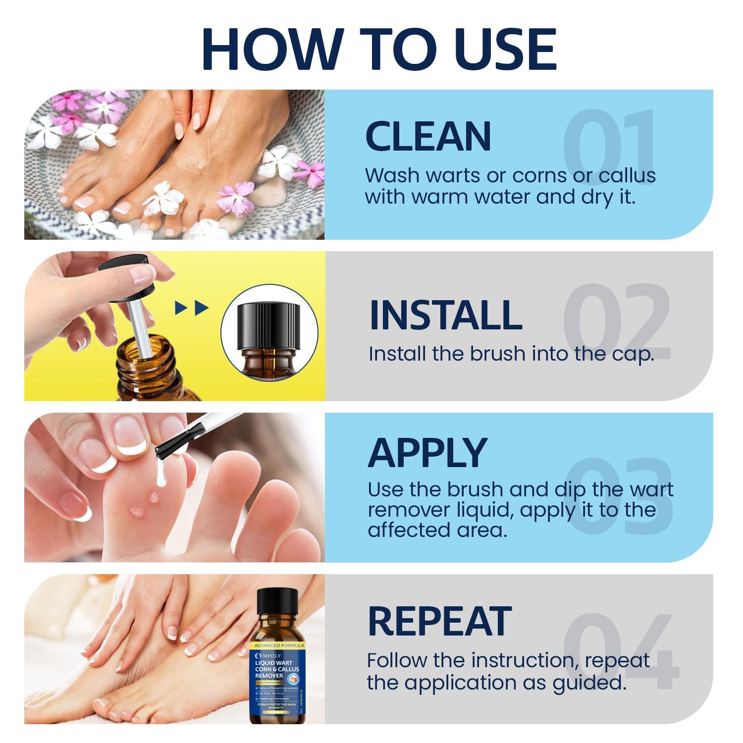 MEOLY Fast-Acting Wart Remover Freeze Off : Salicylic Acid Wart Remover for Men Women - Wart Removal for Plantar Wart, Genital Wart, H Warts, Common Wart, Flat Wart, Corn, Callus 30 ML