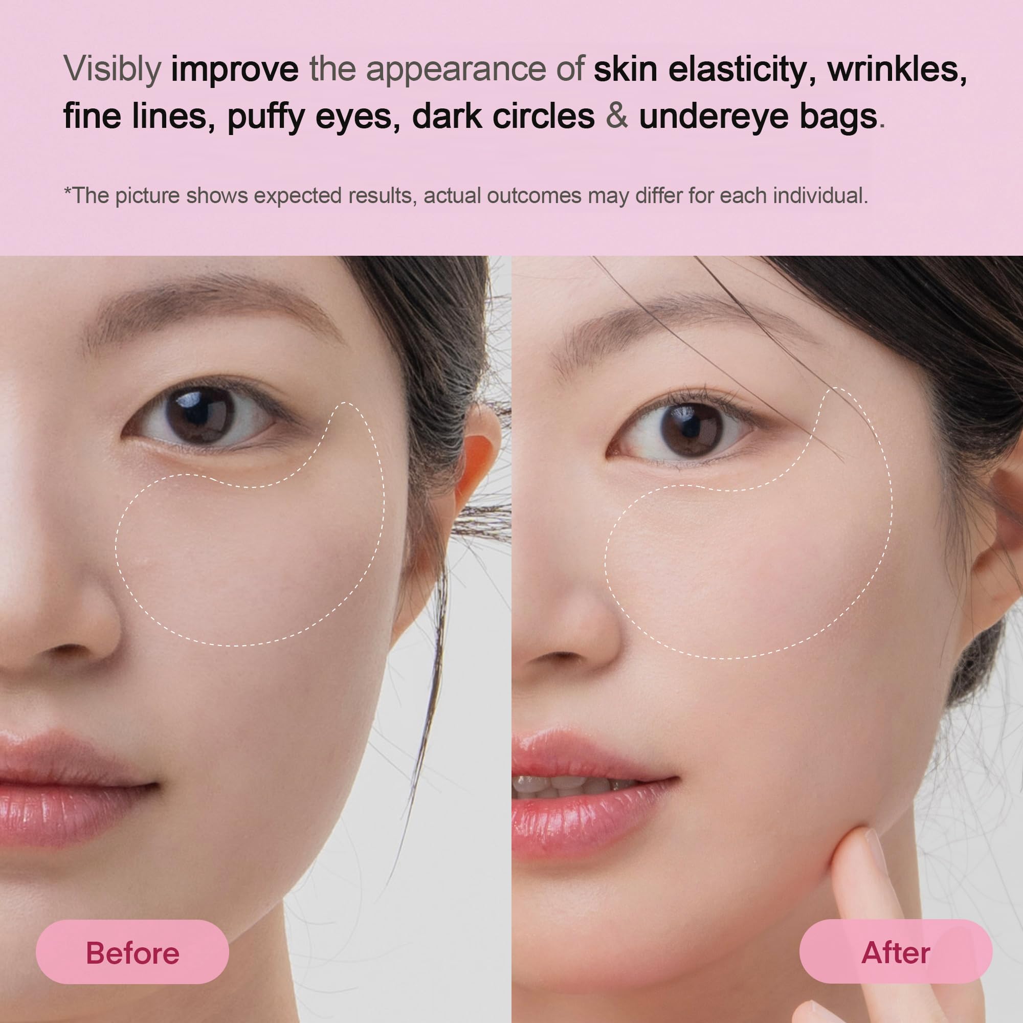 TEREZ & HONOR Collagen Peptide Under Eye Patches - 6 Pairs Korean Firming, Glowing & Hydrating Hydrogel Mask for Puffy Eyes, Dark Circles, Fine Lines - Travel & Gift Ready, Valentine’s Day for Her