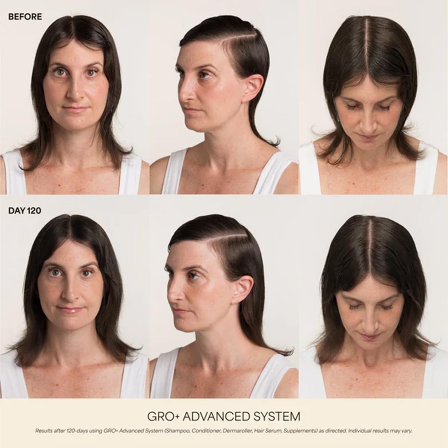 VEGAMOUR GRO+ Advanced Hair Serum for Improving Hair Density, Tonic Reduces Shedding and Promotes a Healthy Scalp, 30 Day Supply, 1 fl oz, New Packaging