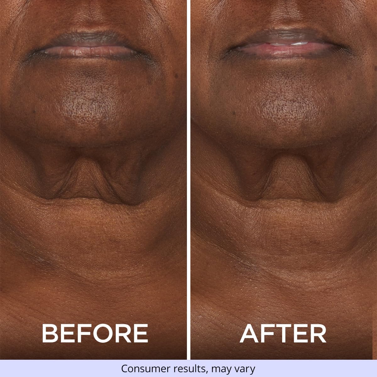 goPure Neck Firming Cream - Anti-Aging Neck Cream for Tightening and Wrinkles for an Even Skin Tone and Neck Lift - With Pro-Active Firming Complex, 1.7 oz