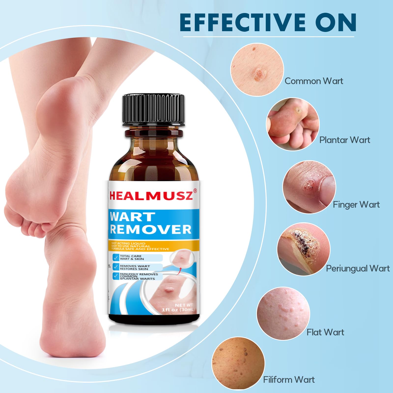 HEALMUSZ Fast-Acting Wart Remover Freeze Off,Salicylic Acid Wart Remover for Men Women-Wart Removal for Plantar Wart,Genital Wart,H Warts,Common Wart,Flat Wart,Corn,Callus 30 ML. (1Pc, Fresh)