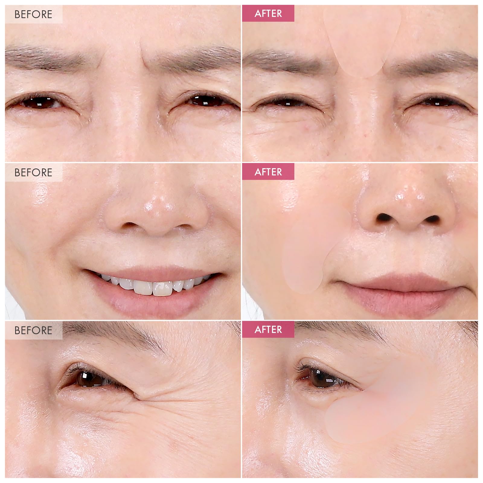 TOSOWOONG Anti-Wrinkle Patch with Hydrolyzed Collagen, Forehead & Eye & Smile Line Wrinkle Patches, Anti-Wrinkle Tape, K-Beauty Overnight Under Eye Patches, Korean Skincare, 5ea (10patches X 5)