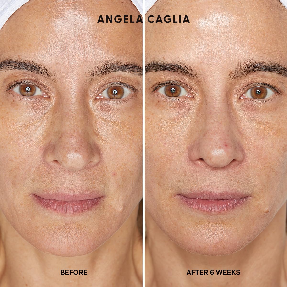 Angela Caglia Cell Forte Serum - Powered by BIOMSC™️ Skincare Technology for Fine Lines and Wrinkles