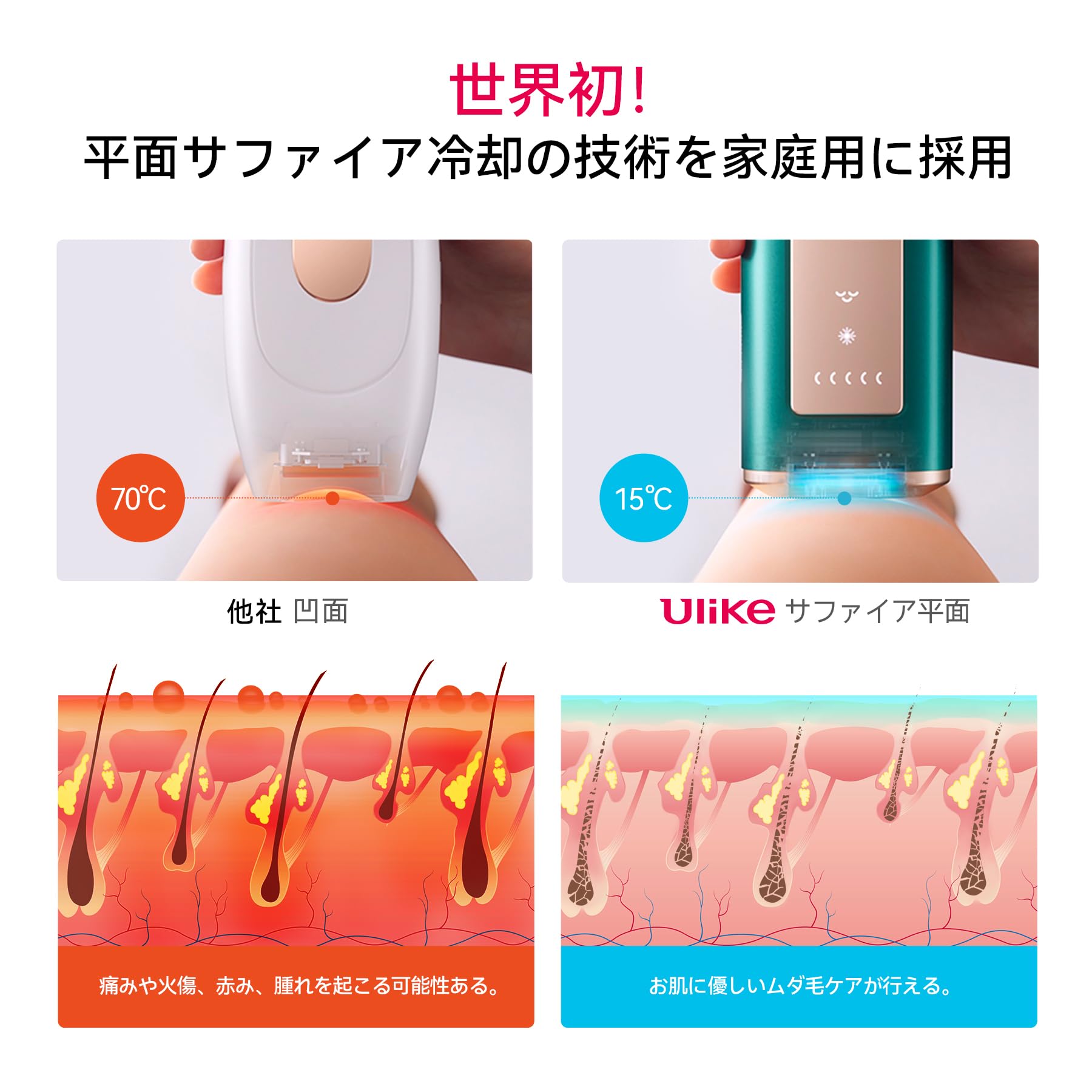 Ulike Laser Hair Removal for Women and Men, Air+ IPL Hair Removal Device with Ice-Cooling Technology for Nearly Painless Result, Safe&Long-Lasting for Reducing in Hair Growth for Body & Face