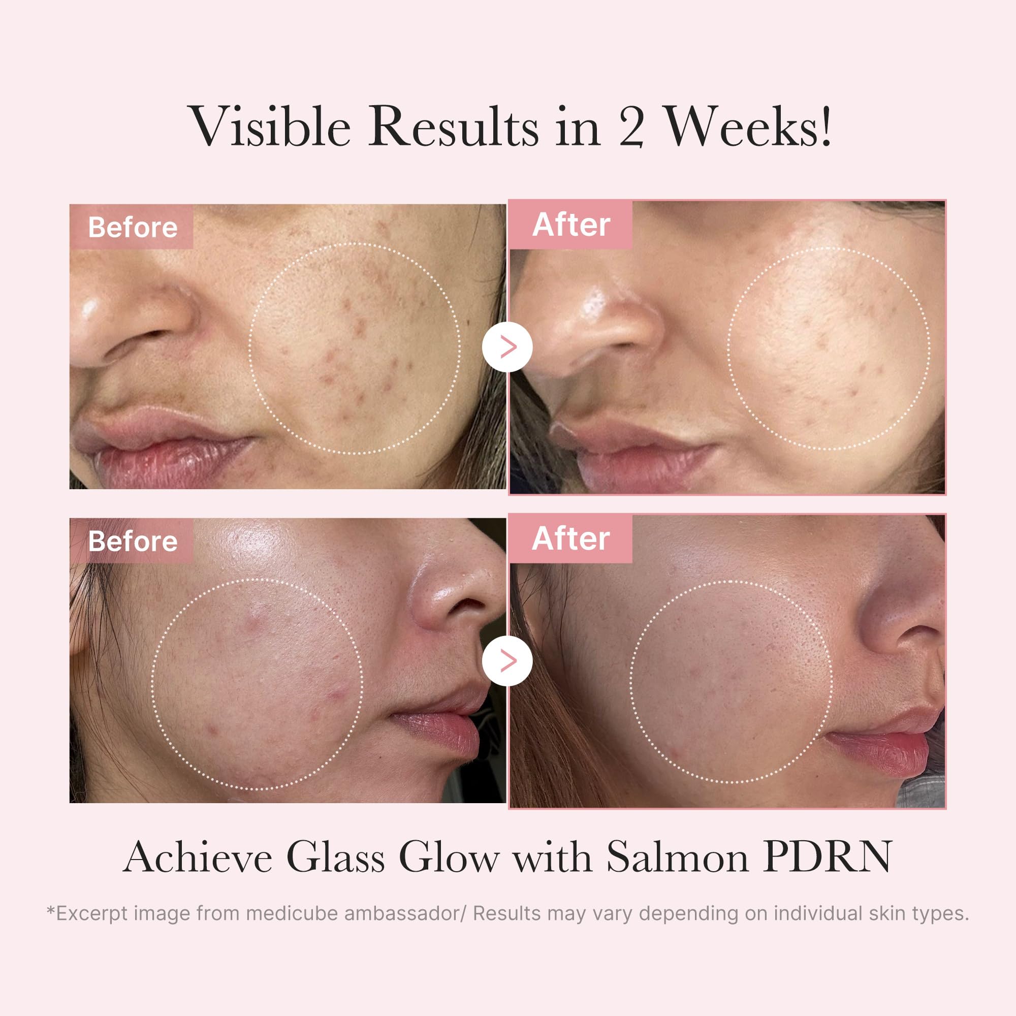 medicube Salmon DNA PDRN Trial Kit | Glass Glow Mini Skincare Set with Toner, Serum & Sheet Mask for Hydrating, Firming, Moisturizing |Gift & Travel Essentials for Women & Girls | Korean Skincare