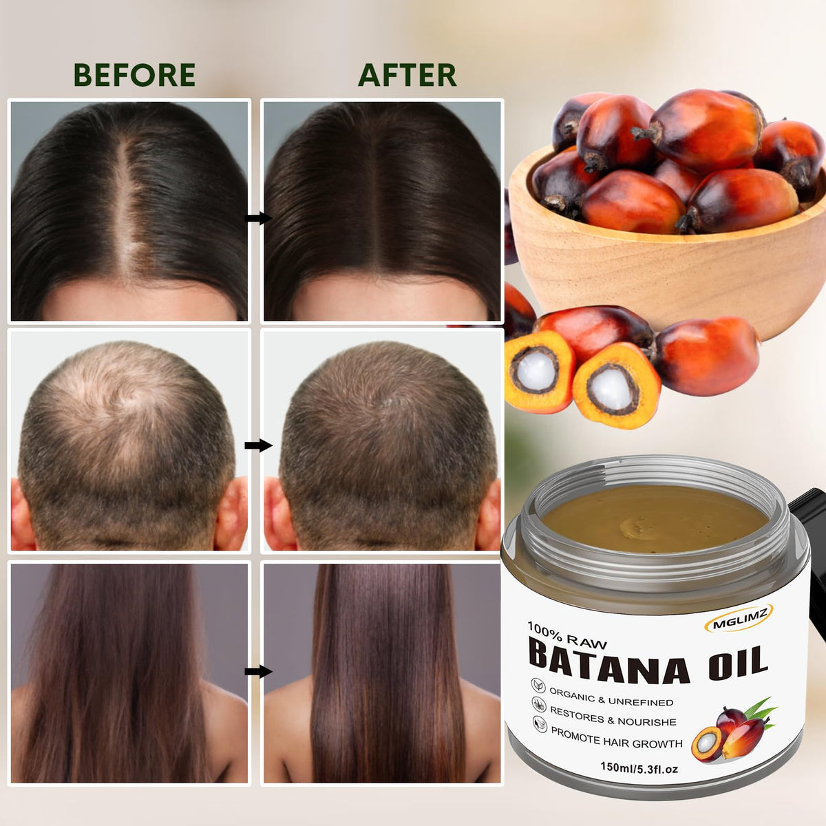 MGLIMZ Natural 100% Raw Batana Oil, 5.3 Fl Oz for Thicker Fuller Hair Growth ,Prevents Hair Loss, Repairs Splitting, Drying and Injuring Hair.