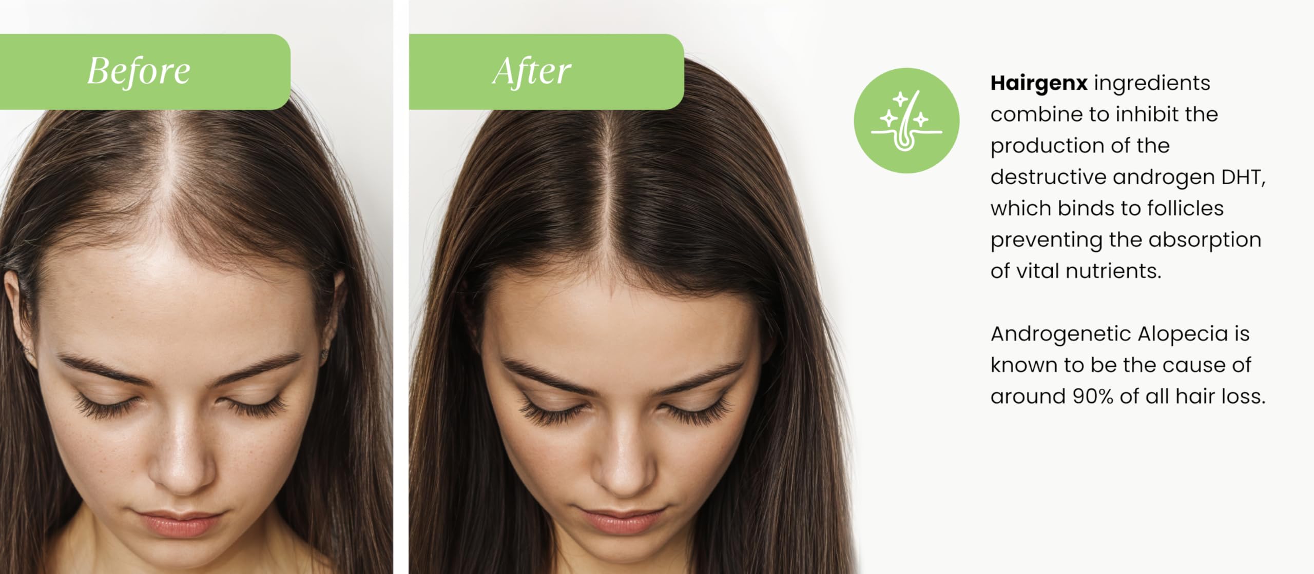 Hairgenx for HER | 150 Herbal Capsules (75 Day Supply) | DHT Blocker for Thicker, Fuller Hair | Natural Herbal Hair Loss Supplement for Women | Gluten-Free, Vegan-Friendly