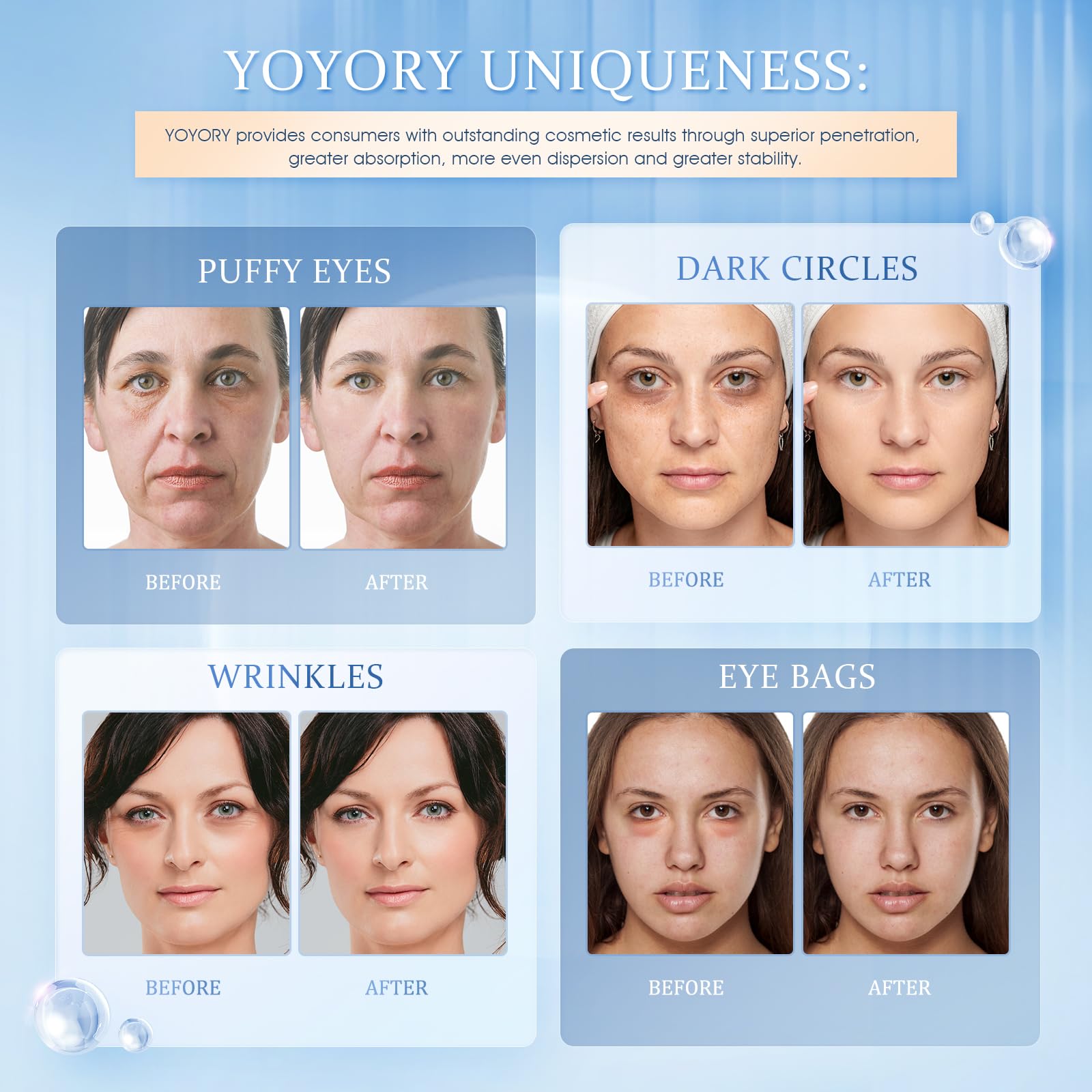 YOYORY Under Eye Patches Masks - Reduce Puffy Eyes, Dark Circles,Undereye Bags, Wrinkles,Infused Peptide Collagen and Hyaluronic Acid,Vegan Cruelty-Free Self Care