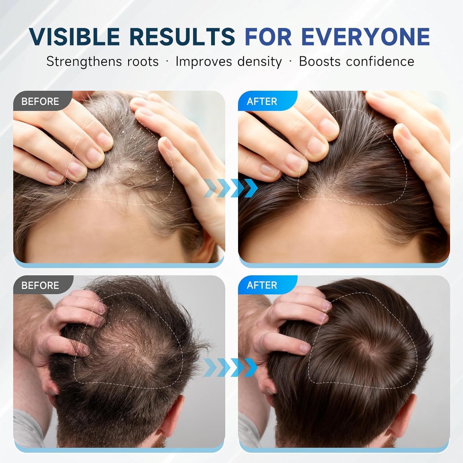 OVEXLIO Hair Growth Shampoo with Biotin & Rosemary for Thinning Hair for Women, Anti Hair Loss Shampoo, Natural Thickening Formula, Sulfate Free with Comb, 11.84 fl oz