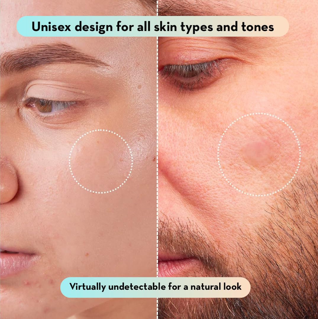 LE GUSHE Korean Pimple Patches for Face (132 dots) - Hydrocolloid Acne Patches with Tea Tree Oil - Invisible Blemish Patches - Dermatologist Tested Zit Patches | Korean Skin Care