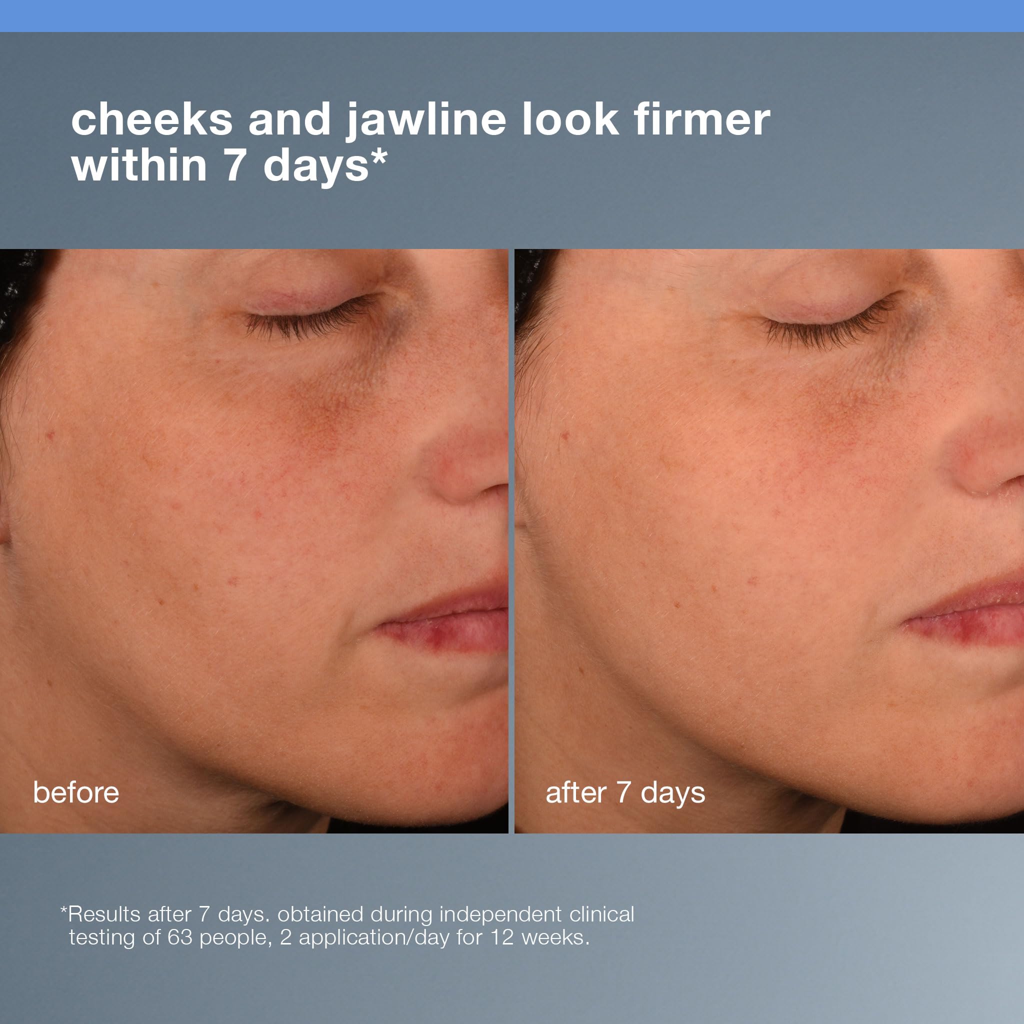 Dermalogica Pro Collagen Banking Serum for Face, Plumping and Preserving Skin's Collagen, Prevent Wrinkles and Fine Lines with Amino Acid, 1 fl oz