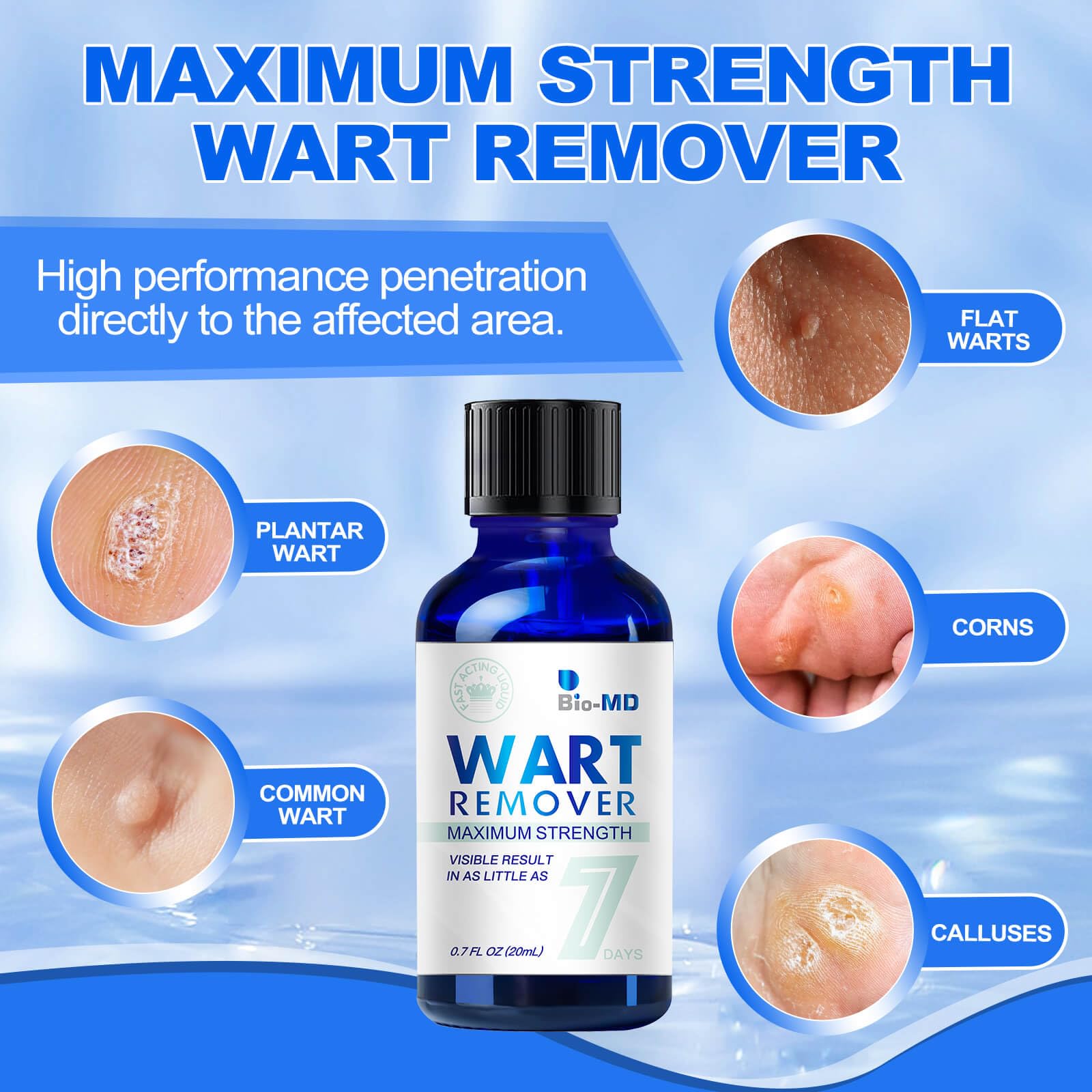 Fast Acting Gel Wart Remover Freeze Off - Fast-Acting Wart Freeze Off - Wart Removal for Plantar Wart, Genital Wart, H Warts, Common Wart, Flat Wart, Corn, Callus, Warts, Plantar Wart Remover for Feet