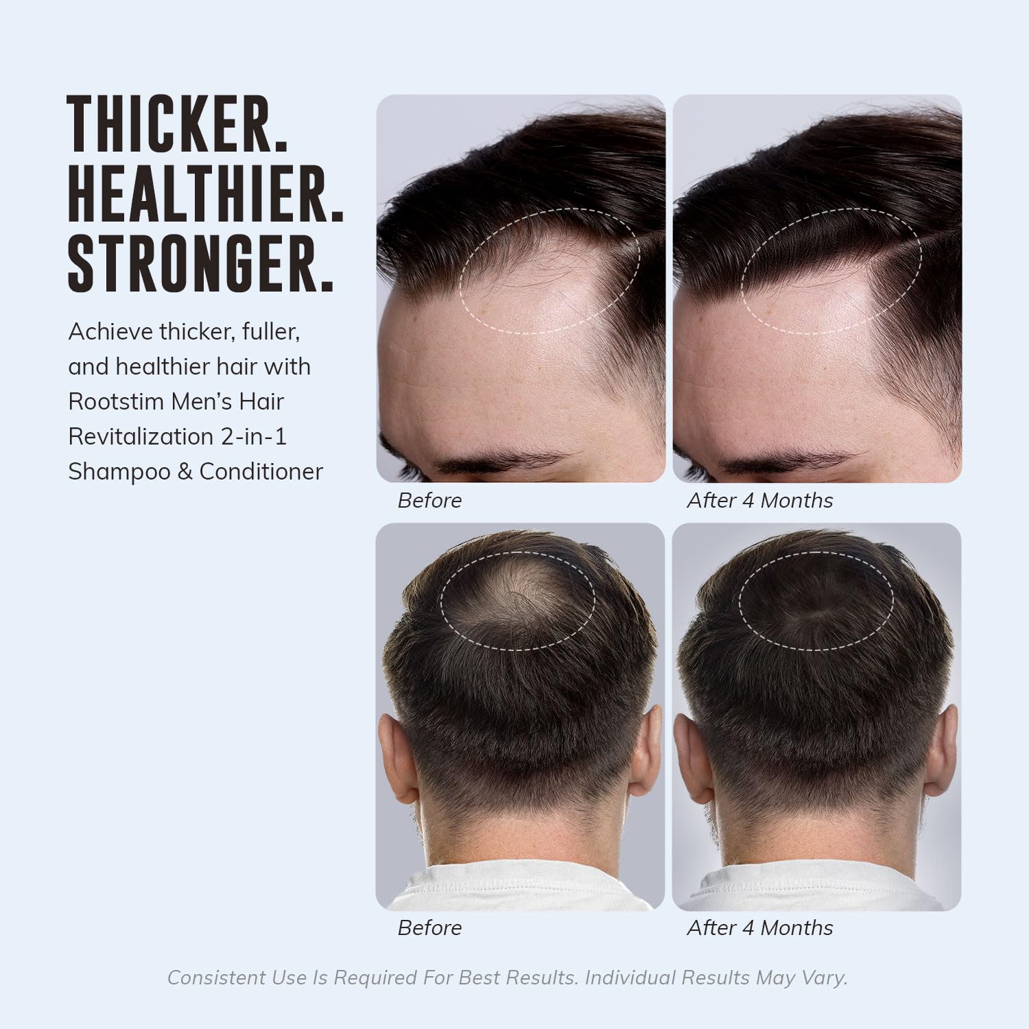 RootStim Men's Hair Thickening & Anti Hair Loss Shampoo with DHT Blocker - 2-in-1 Anti Thinning Shampoo & Conditioner with Biotin, Saw Palmetto & Rosemary Oil for Fuller Hair, Sulfate-Free, 10oz