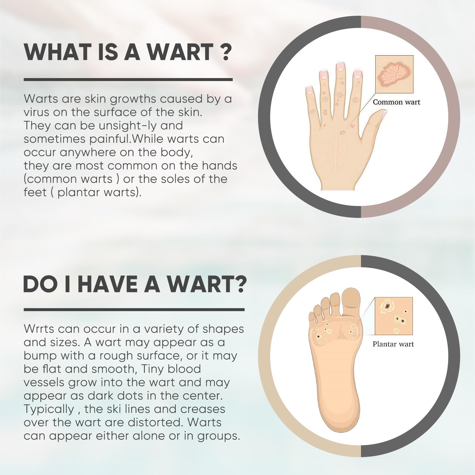WABRINY Wart & Corn Remover Liquid, Smoothes Skin Gentle Fast Acting Gel Wart Removal for Plantar Wart Flat Warts and Corns-G3