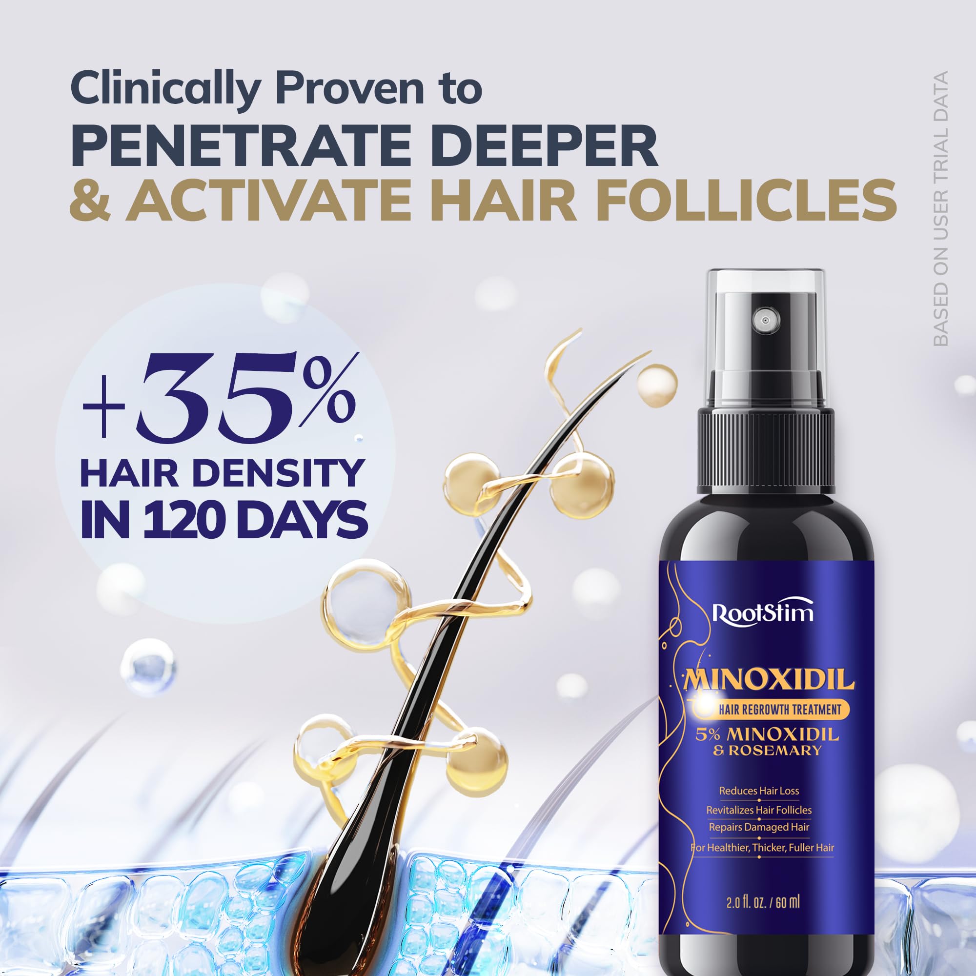 RootStim Hair Regrowth Bundle for Women & Men – Women’s 5% Minoxidil Spray with Rosemary & Biotin (60 mL) + 5% Minoxidil Spray – Extra Strength Hair Thinning & Regrowth