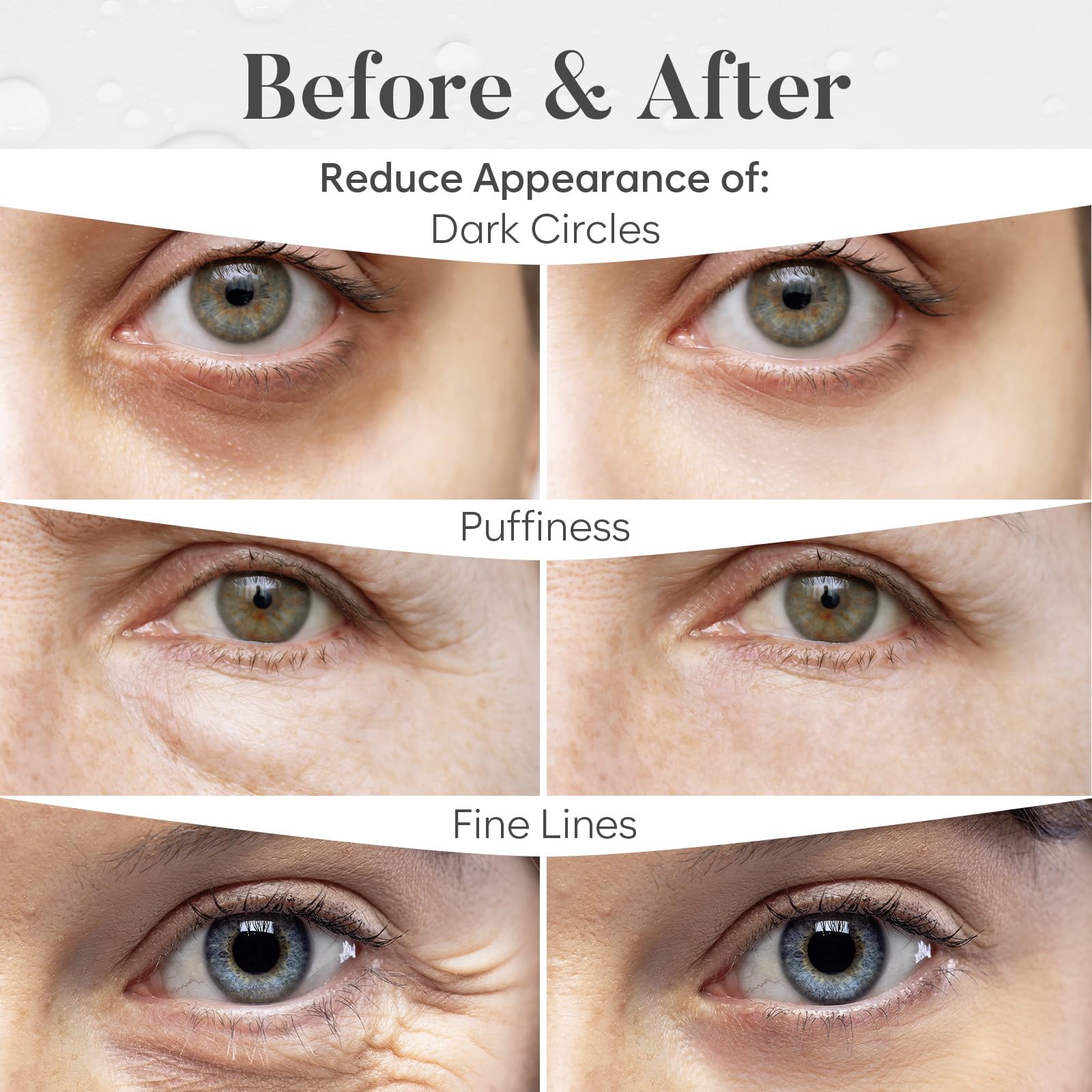 BLOOMORA Green Tea Under Eye Patches (20 Pairs) - Dark Circles & Puffiness Care - Hydrating Green Tea Eye Mask