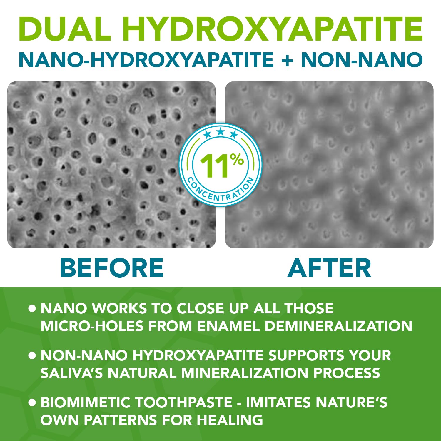 Nano hydroxyapatite Toothpaste Fluoride-Free, Pro Mineralizer Toothpaste: Dentist Formulated Remineralizing Anti Cavity Xylitol Toothpaste, Enamel Support Sensitive Teeth Toothpaste – Wintermint