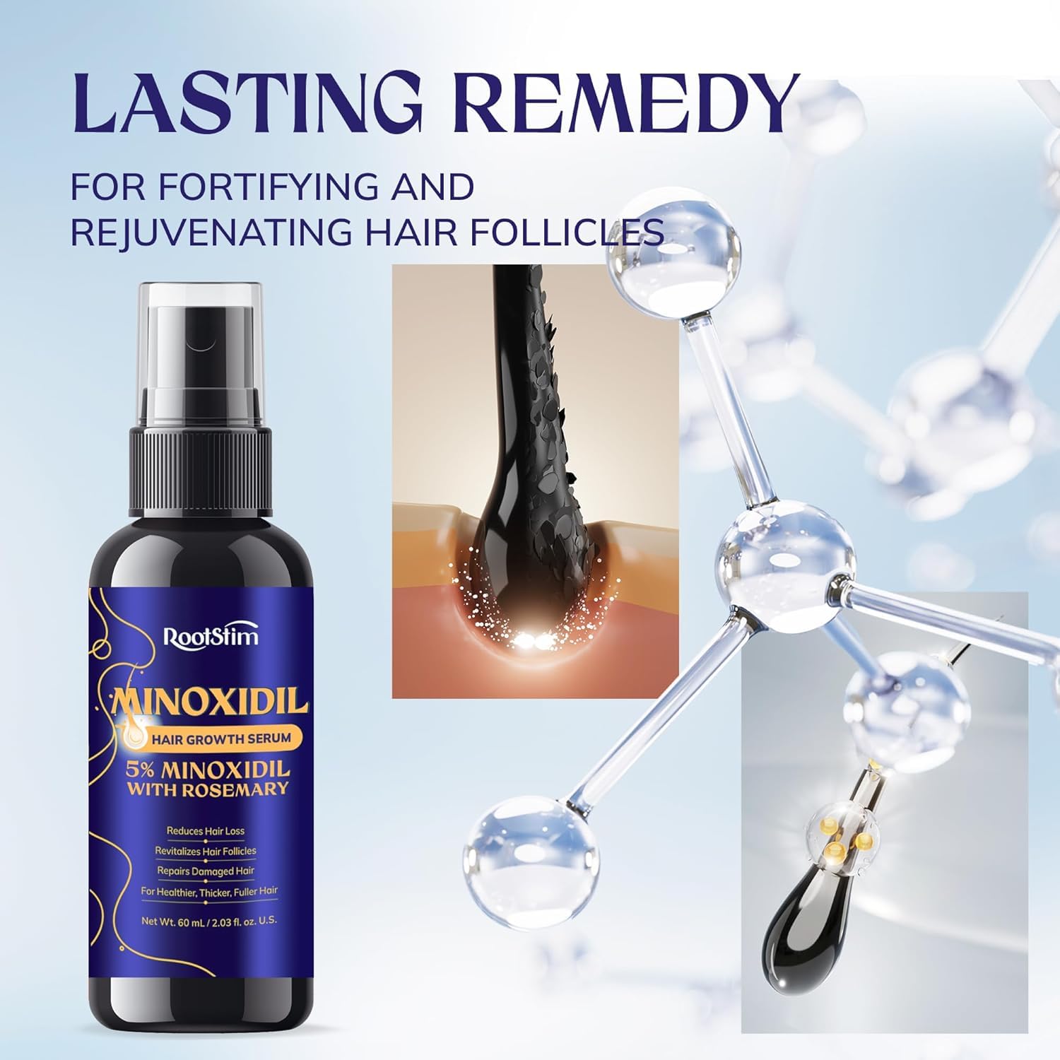 5% Minoxidil Hair Growth for Women and Men: Extra Strength Minoxidil Hair Loss Treatment Serum with Rosemary for Faster Stronger Thicker Hair Growth 60ML