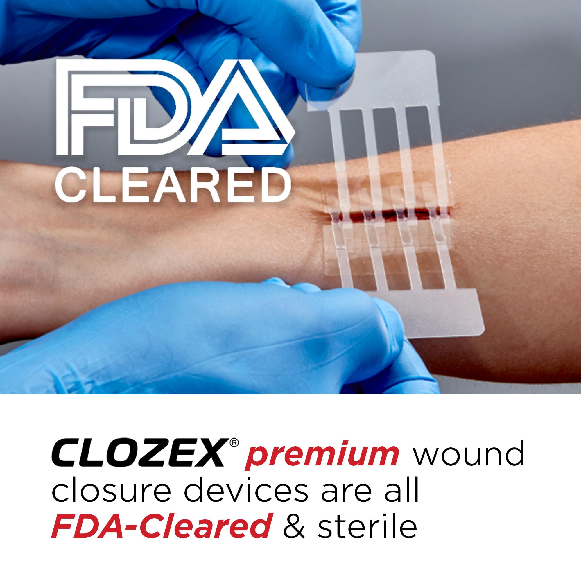 Clozex Wound Closure Device - Repair 3 Individual 3 3/8" Lacerations Without Stitches, FDA Cleared