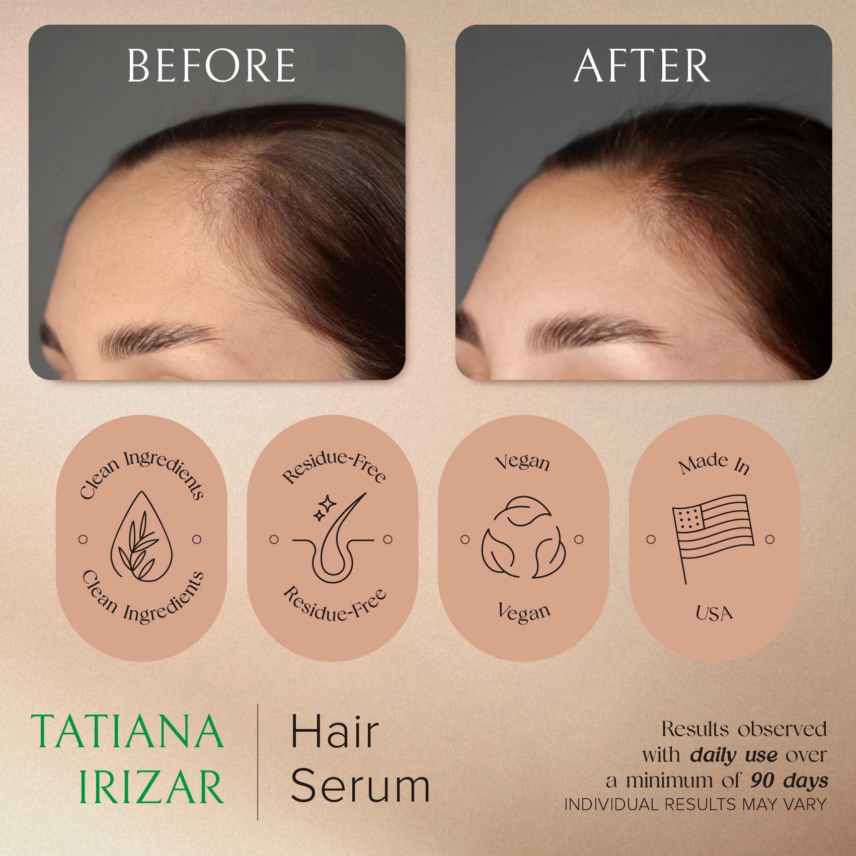 Hair Serum for Hair Growth Serum Women Made in USA - Scalp Serum for Hair Growth Non-Greasy Rosemary & Amla Hair Care - Natural 1 Fl.Oz Hair Loss Treatments for Women Regrowth Treatment