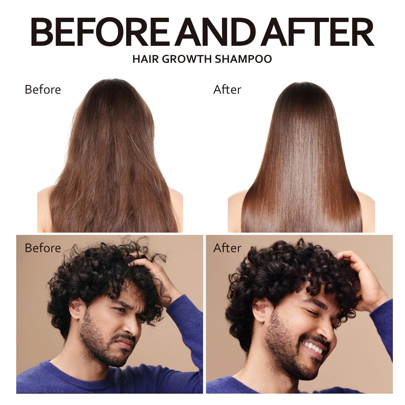 Biotin & Rosemary Hair Growth Shampoo for Thinning Hair for Women, Hair Loss Shampoo for Men, Nourishes Scalp with Natural Ingredients 300 ml