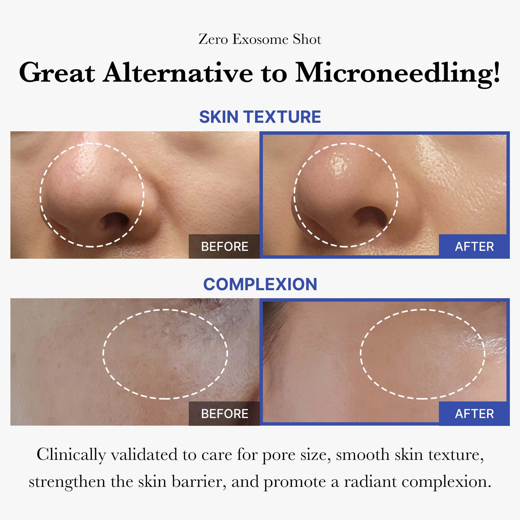 medicube Flawless Skin: Deep Vitamin C Golden Capsule Face Moisturizer and Zero Exosome Shot 7,500 PPM Spicule Facial Serum