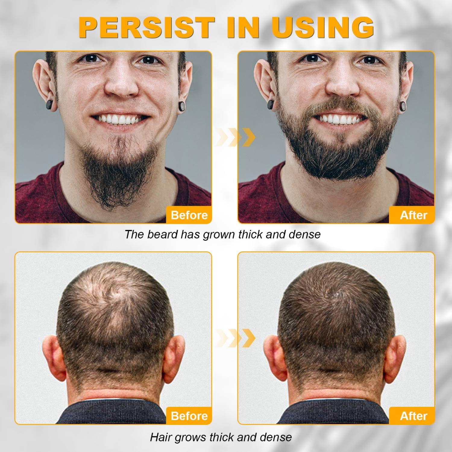 Beard Growth Kit - Beard Kit for Men, Beard Growth Oil (2oz), Beard Balm, Beard Comb, Massager for Spot/Patchy Beard - Christmas, Anniversary, Birthday Gifts for Men, Dad, Husband, Boyfriend